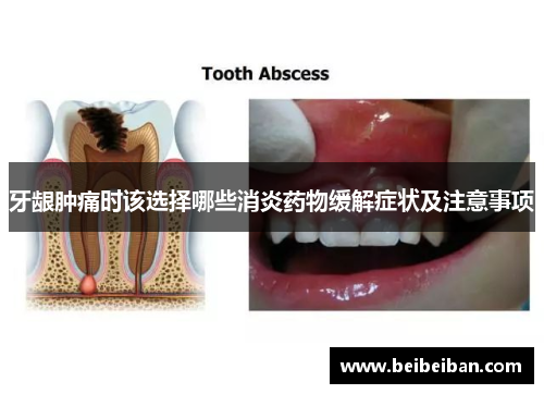 牙龈肿痛时该选择哪些消炎药物缓解症状及注意事项